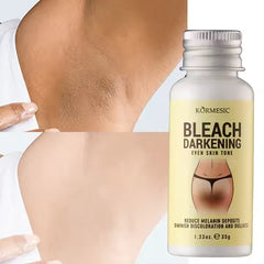 KORMESIC OEM Private label Snow Bleach Dark Spot Removal Cream - 35g