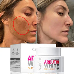 SADOER Nicotinamide Arbutin White Facial Cream 50g