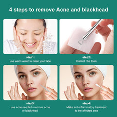 Tv Parlour Black Heads Pin