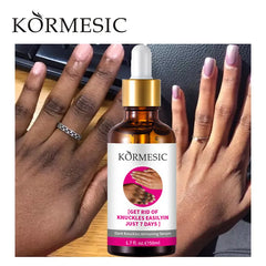 Kormesic Hand Dark Knuckle Whitening Brightening Serum - 50ml