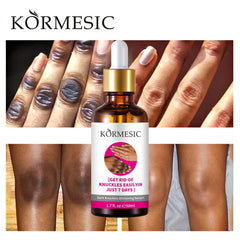 Kormesic Hand Dark Knuckle Whitening Brightening Serum - 50ml